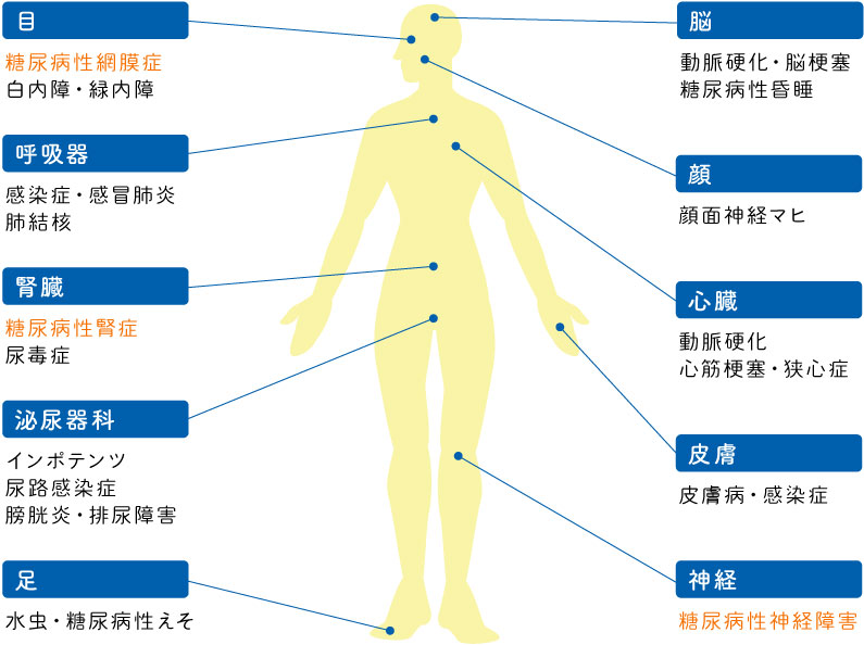 目（糖尿病性網膜症・白内障・緑内障）呼吸器（感染症・感冒肺炎・肺結核）腎臓（糖尿病性腎症・尿毒症）泌尿器科（インポテンツ・尿路感染症・膀胱炎・排尿障害）足（水虫・糖尿病性えそ）脳（動脈硬化・脳梗塞・糖尿病性昏睡）顔（顔面神経マヒ）心臓（動脈硬化・心筋梗塞・狭心症）皮膚（皮膚病・感染症）神経（糖尿病性神経障害）